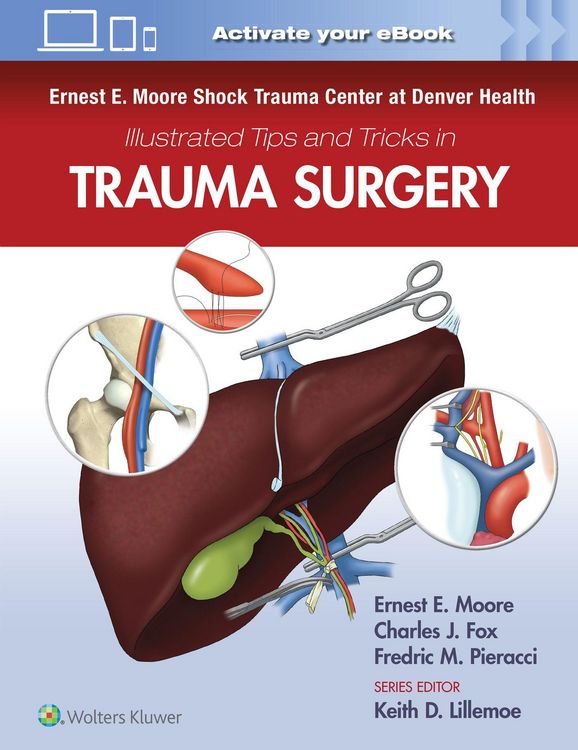 Produktbild: Ernest E. Moore Shock Trauma Center at Denver Health Illustrated Tips and Tricks in Trauma Surgery