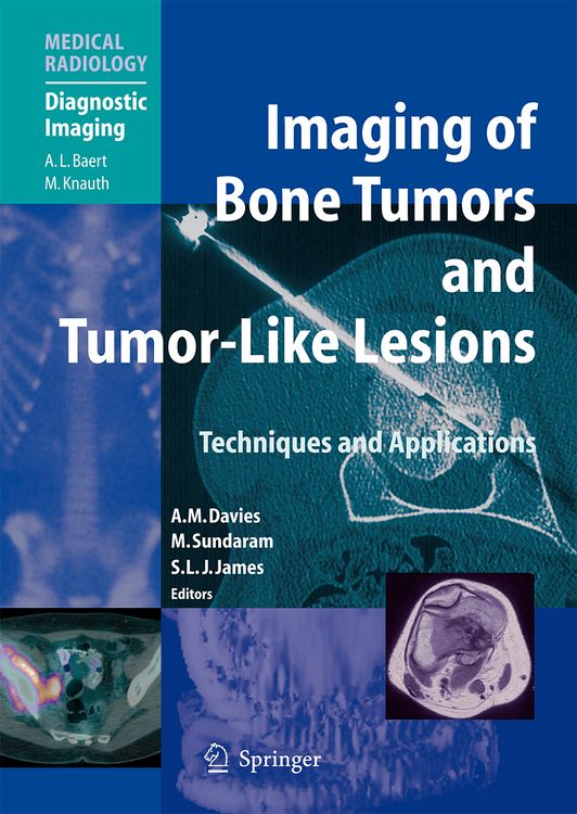 Produktbild: Imaging of Bone Tumors and Tumor-Like Lesions