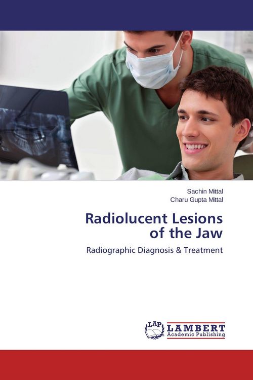Produktbild: Radiolucent Lesions of the Jaw