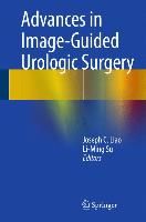 Produktbild: Advances in Image-Guided Urologic Surgery