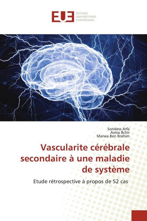 Produktbild: Vascularite c&eacute;r&eacute;brale secondaire &agrave; une maladie de syst&egrave;me
