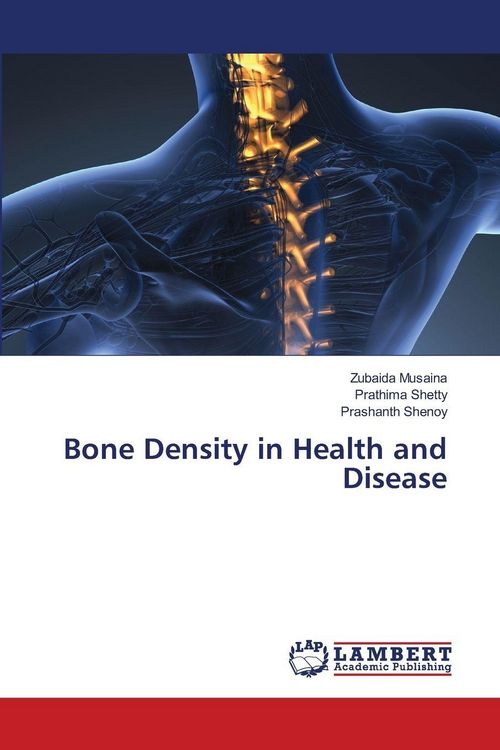 Produktbild: Bone Density in Health and Disease