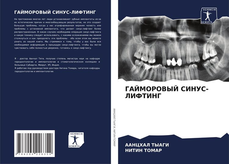 Produktbild: Gajmorovyj Sinus-Lifting