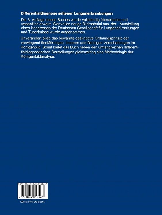 Produktbild: Differentialdiagnose seltener Lungenerkrankungen im R&ouml;ntgenbild