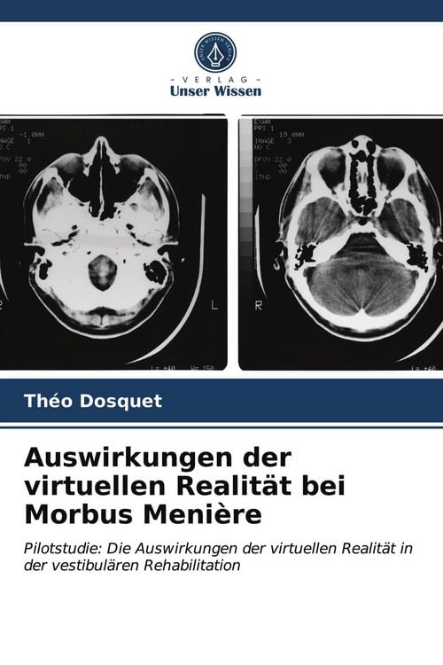 Produktbild: Auswirkungen der virtuellen Realit&auml;t bei Morbus Meni&egrave;re
