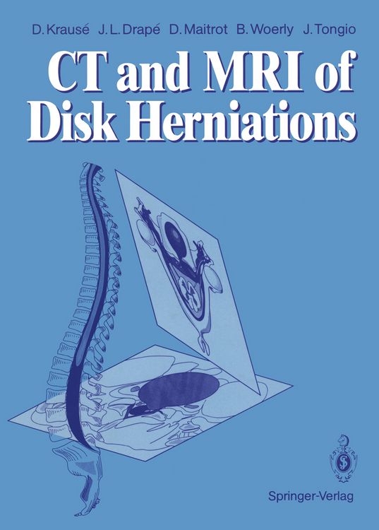 Produktbild: CT and MRI of Disk Herniations