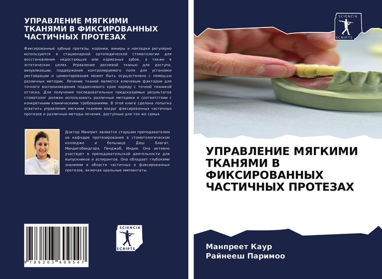 Produktbild: Upravlenie Myagkimi Tkanyami V Fiksirovannyh Chastichnyh Protezah