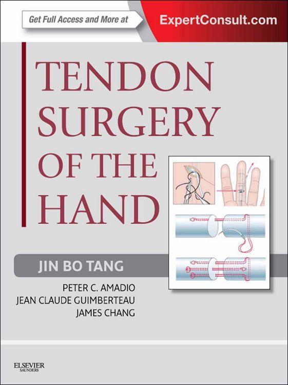 Produktbild: Tendon Surgery of the Hand E-Book