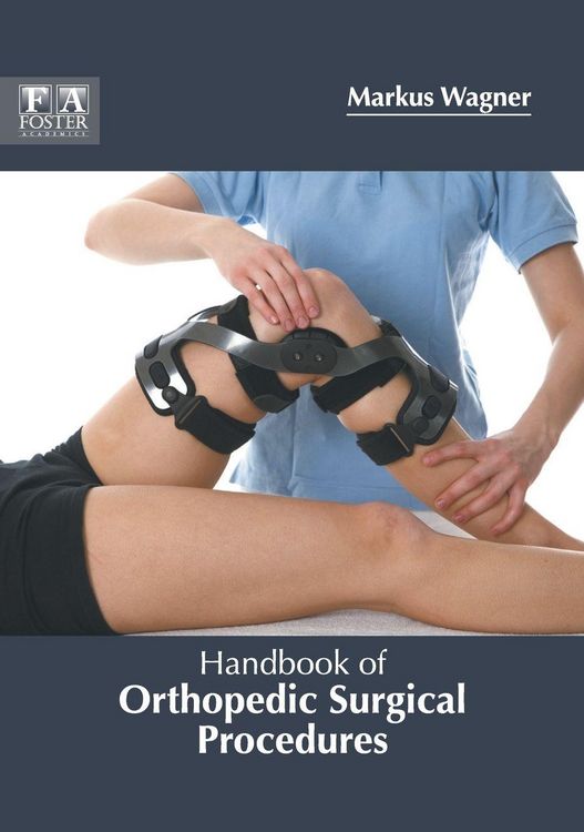 Produktbild: Handbook of Orthopedic Surgical Procedures