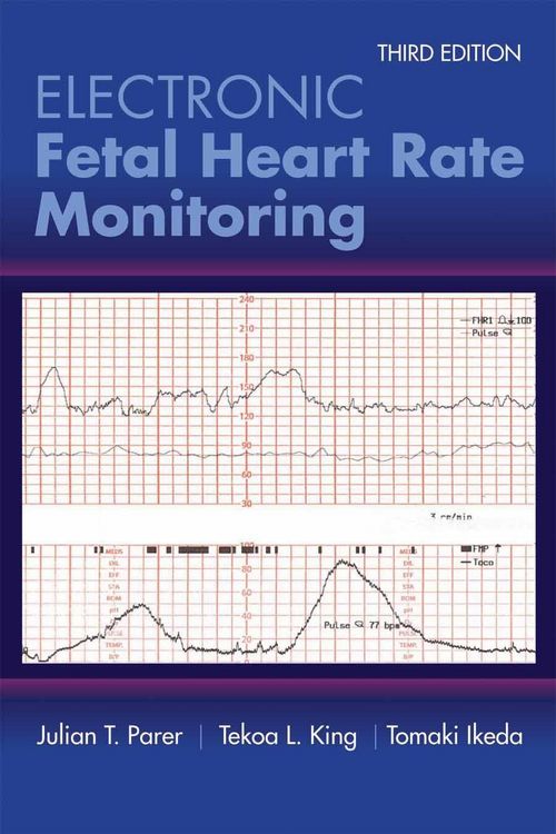 Produktbild: Electronic Fetal Heart Rate Monitoring: The 5-Tier System