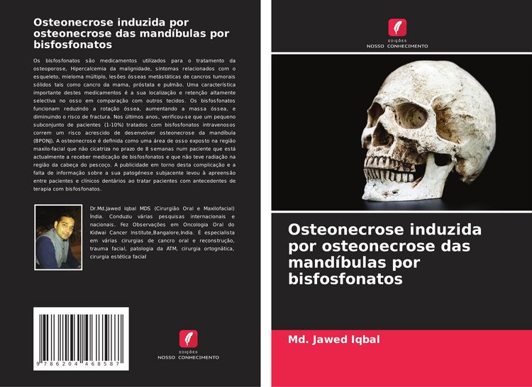 Produktbild: Osteonecrose induzida por osteonecrose das mand&iacute;bulas por bisfosfonatos