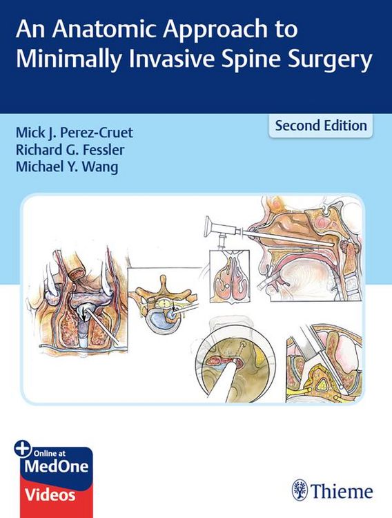 Produktbild: An Anatomic Approach to Minimally Invasive Spine Surgery