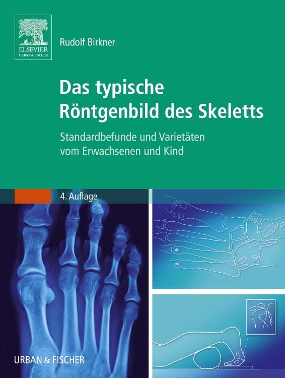 Produktbild: Das typische R&ouml;ntgenbild des Skeletts