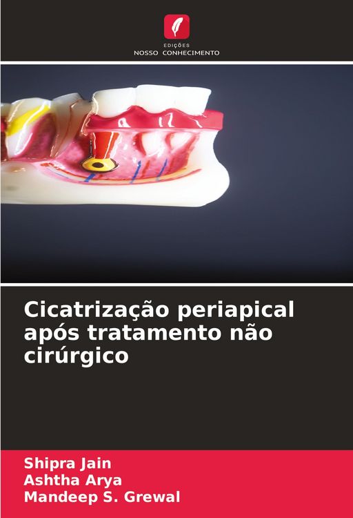 Produktbild: Cicatriza&ccedil;&atilde;o periapical ap&oacute;s tratamento n&atilde;o cir&uacute;rgico