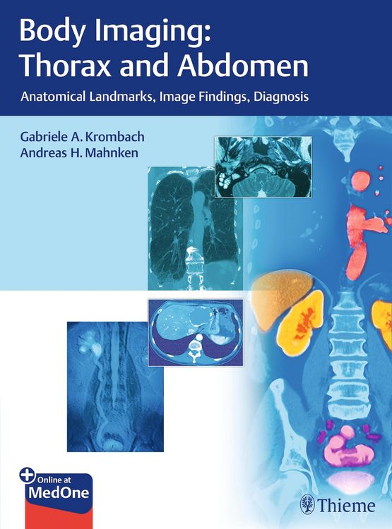 Produktbild: Body Imaging: Thorax and Abdomen