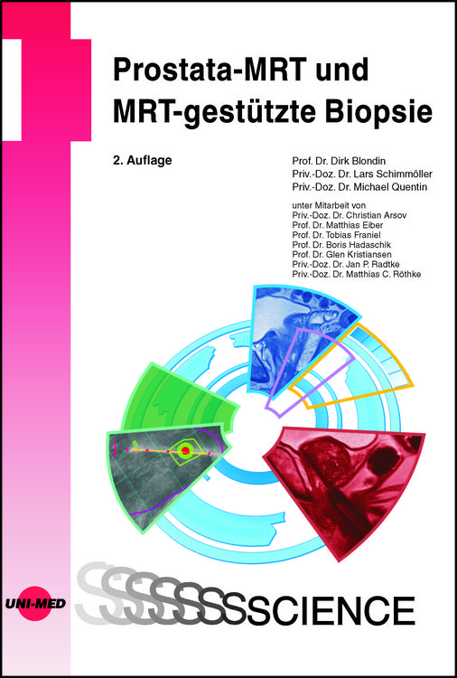 Produktbild: Prostata-MRT und MRT-gest&uuml;tzte Biopsie