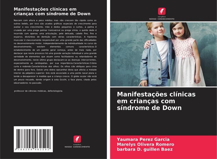 Produktbild: Manifesta&ccedil;&otilde;es cl&iacute;nicas em crian&ccedil;as com s&iacute;ndrome de Down