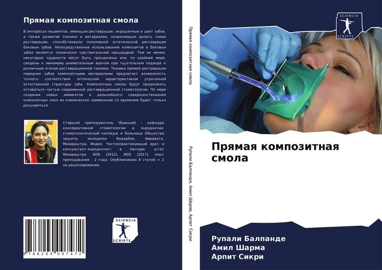 Produktbild: Prqmaq kompozitnaq smola