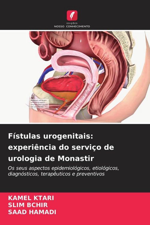 Produktbild: F&iacute;stulas urogenitais: experi&ecirc;ncia do servi&ccedil;o de urologia de Monastir