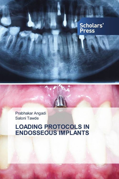 Produktbild: Loading Protocols in Endosseous Implants