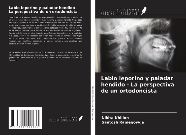 Produktbild: Labio leporino y paladar hendido - La perspectiva de un ortodoncista