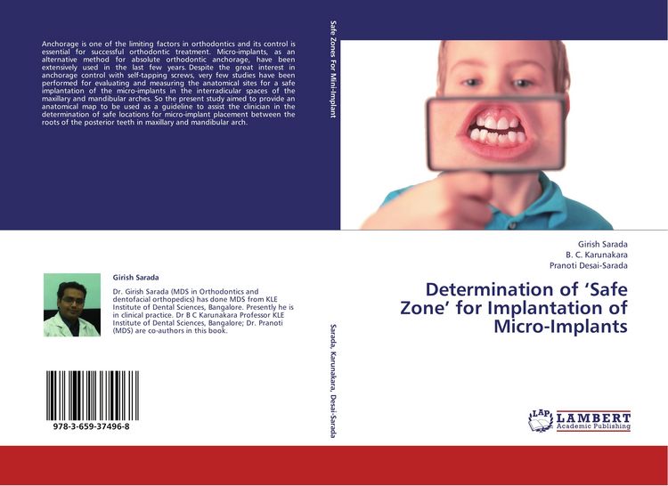 Produktbild: Determination of 'Safe Zone' for Implantation of Micro-Implants