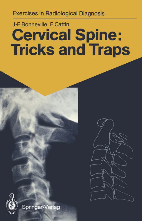 Produktbild: Cervical Spine: Tricks and Traps
