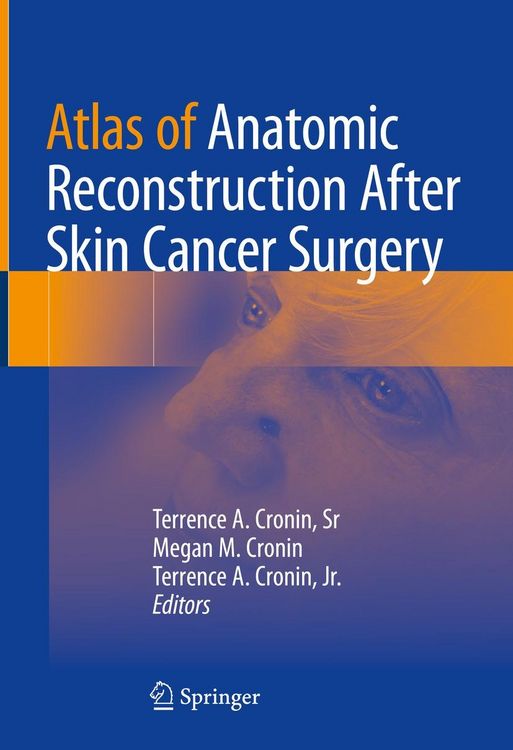 Produktbild: Atlas of Anatomic Reconstruction After Skin Cancer Surgery