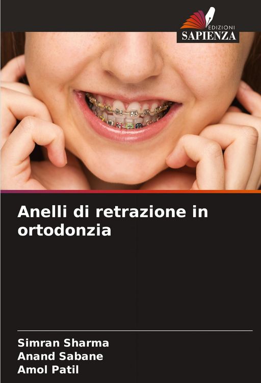 Produktbild: Anelli di retrazione in ortodonzia