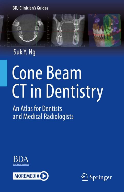 Produktbild: Cone Beam CT in Dentistry