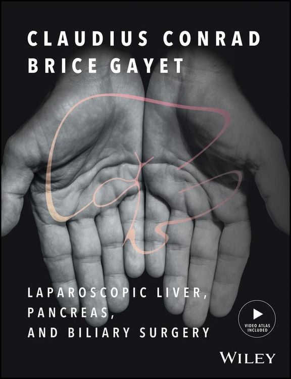 Produktbild: Laparoscopic Liver, Pancreas, and Biliary Surgery