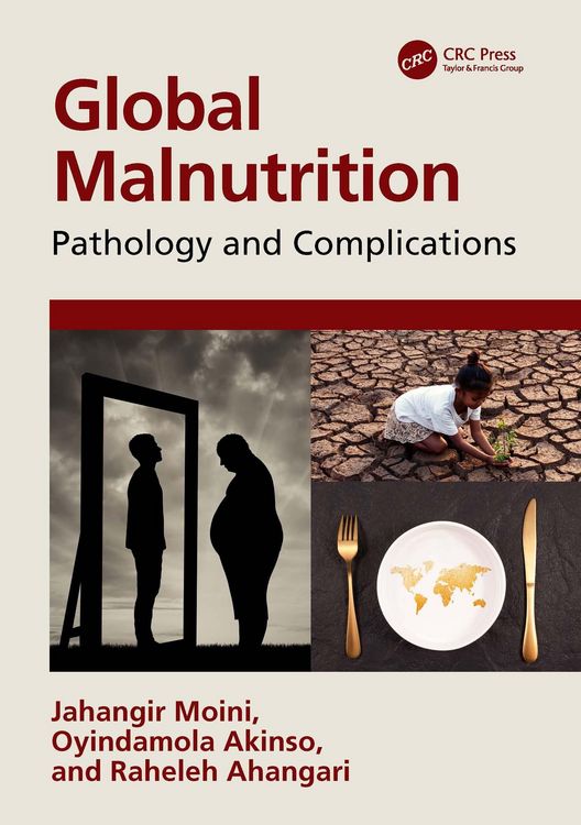 Produktbild: Global Malnutrition