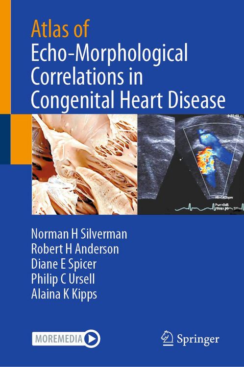 Produktbild: Atlas of Echo-Morphological Correlations in Congenital Heart Disease