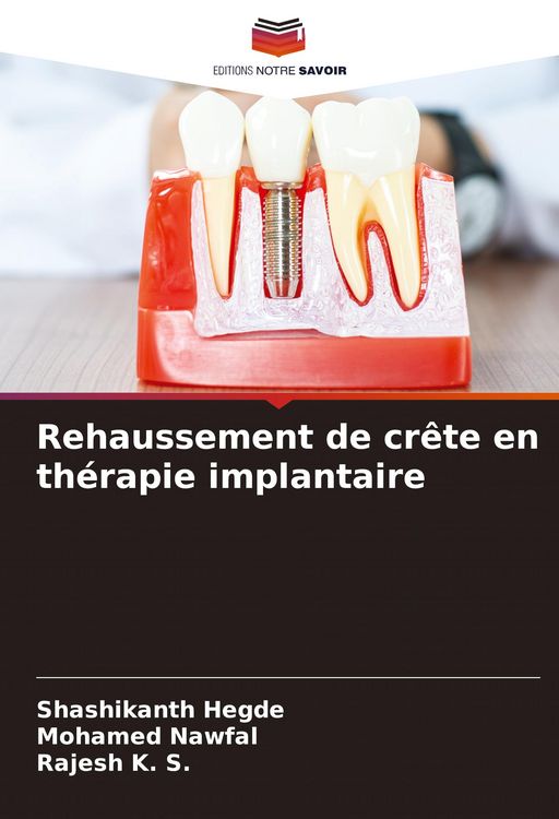 Produktbild: Rehaussement de cr&ecirc;te en th&eacute;rapie implantaire