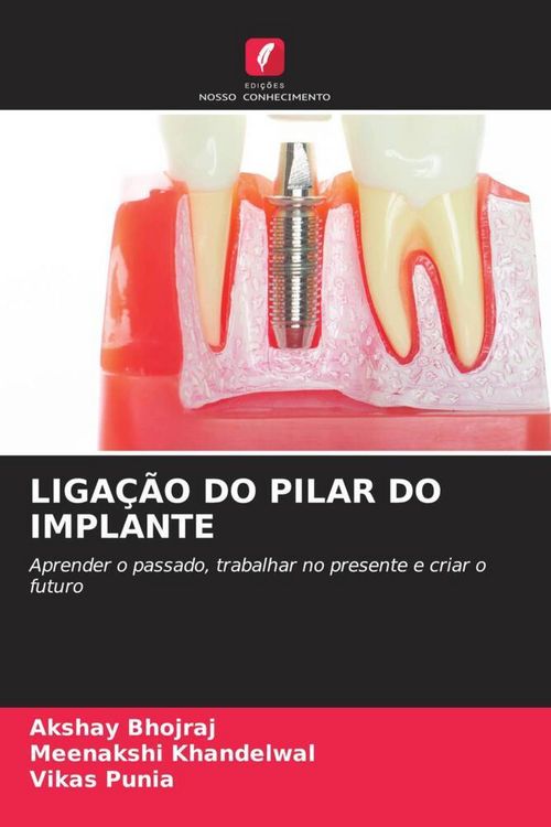 Produktbild: LIGA&Ccedil;&Atilde;O DO PILAR DO IMPLANTE
