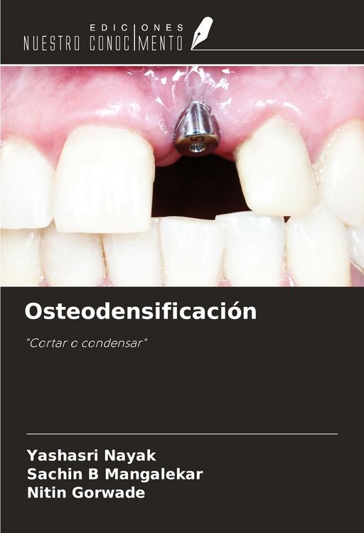 Produktbild: Osteodensificaci&oacute;n