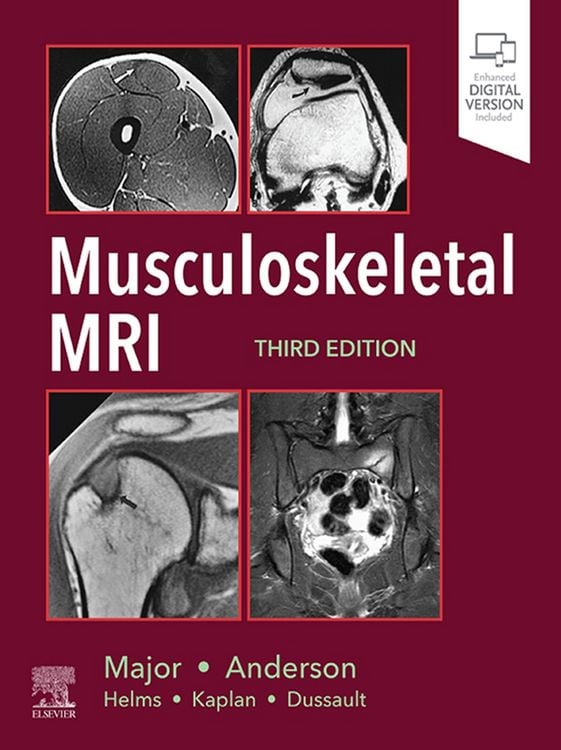 Produktbild: Musculoskeletal MRI E-Book