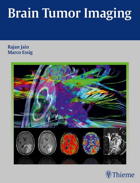 Produktbild: Brain Tumor Imaging