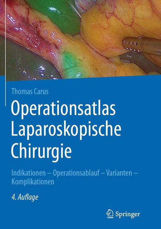 Produktbild: Operationsatlas Laparoskopische Chirurgie