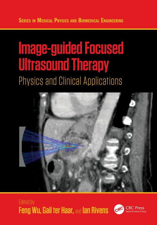 Produktbild: Image-guided Focused Ultrasound Therapy