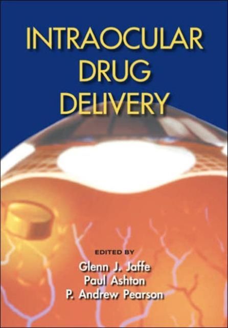 Produktbild: Intraocular Drug Delivery
