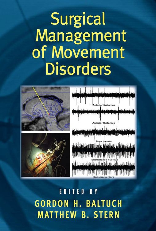 Produktbild: Surgical Management of Movement Disorders