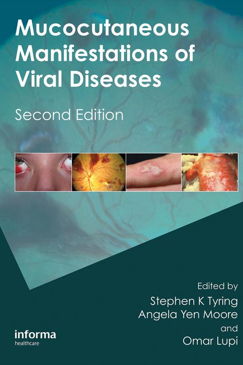 Produktbild: Mucocutaneous Manifestations of Viral Diseases