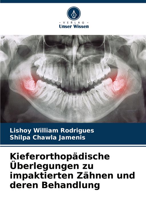 Produktbild: Kieferorthop&auml;dische &Uuml;berlegungen zu impaktierten Z&auml;hnen und deren Behandlung