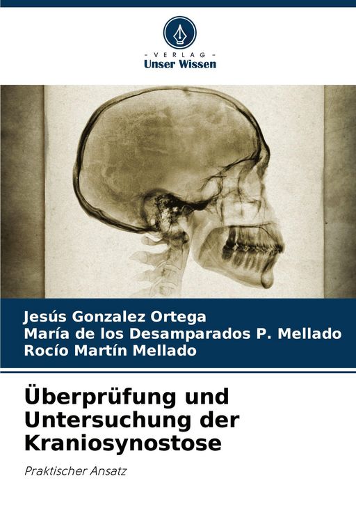 Produktbild: &Uuml;berpr&uuml;fung und Untersuchung der Kraniosynostose