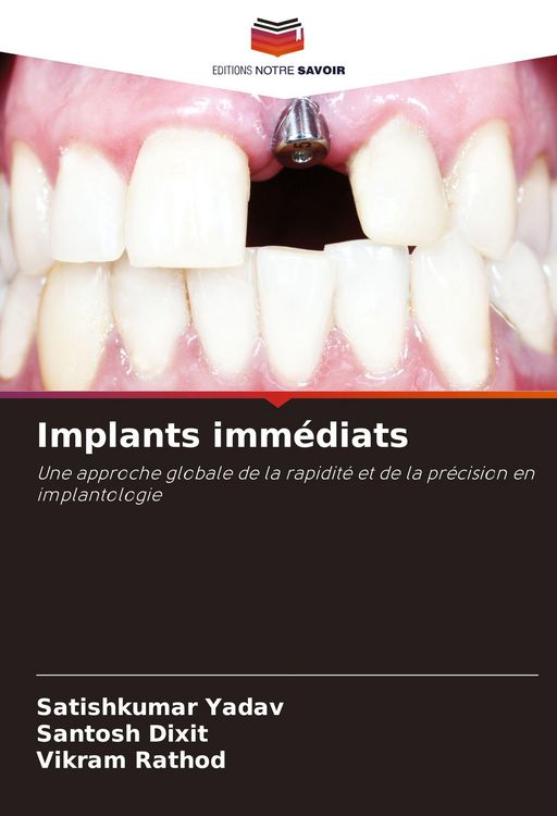 Produktbild: Implants imm&eacute;diats