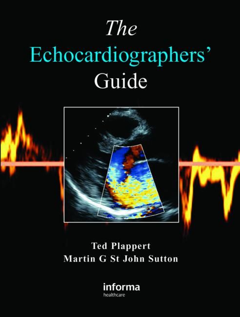 Produktbild: The Echocardiographers' Guide
