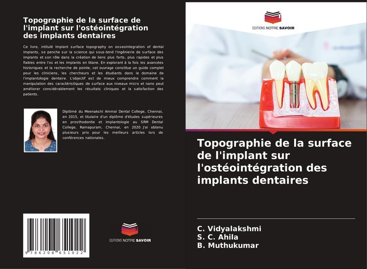 Produktbild: Topographie de la surface de l'implant sur l'ost&eacute;oint&eacute;gration des implants dentaires