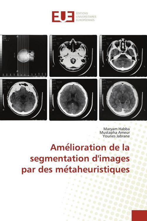 Produktbild: Ame&iquest;lioration de la segmentation d'images par des me&iquest;taheuristiques