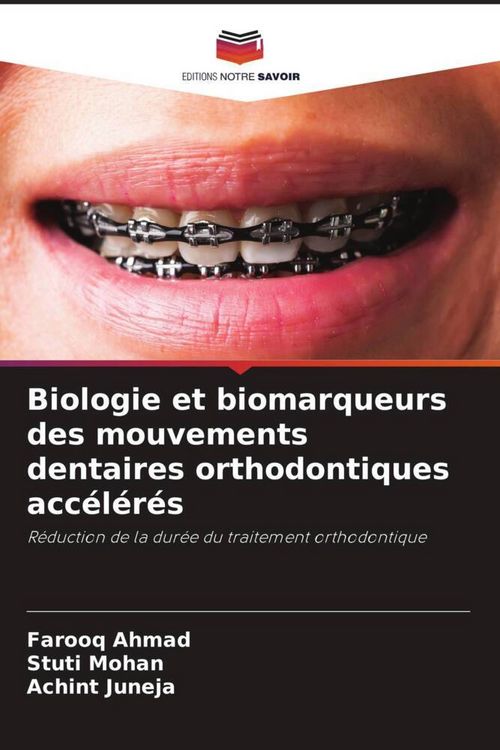 Produktbild: Biologie et biomarqueurs des mouvements dentaires orthodontiques acc&eacute;l&eacute;r&eacute;s
